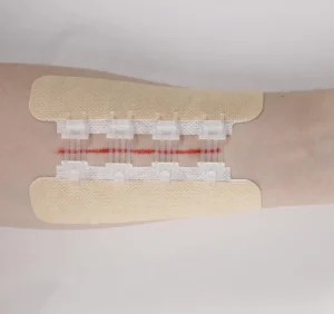Medical Sterile Skin Color Wound Care Zipper First Aid Stitch Tape Wound Closure Device Category Steri Strips