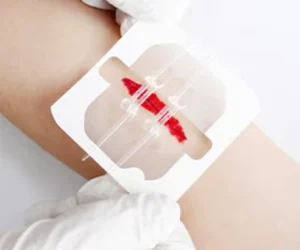 Medical Transparent Wound Closure Film Emergency Zip Stitch Dressing Device Steri Strips