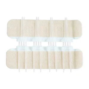 Medical Wound Closure Device Surgical Stitch Zip Stitch Medic