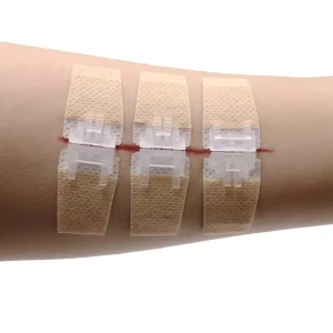 Medical Wound Skin Closure Device Non woven Wound Closure Device