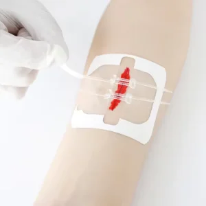 Medical Wound Skin PU Film Closure Device Non woven Wound Closure Device Without Suture