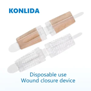 Medical Zip Stitch Wound Closure Zipper Skin Wound Closure Device