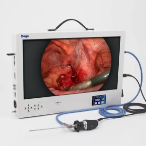 Minimally Invasive Surgery Portable Electric Metal Endoscope Camera 24 Inch FHD 1080P for Surgical Instruments