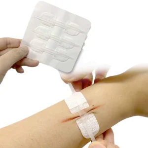 New Design Magic Stitchless Wound Closure Device Adhesive Sterile Wound Skin Closure Zip Stitch
