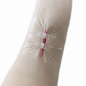 Non Invasive Device Skin Zipper Butterfly Bandage Kit Wound Closure Film Emergency Closures Wound Closure Strip