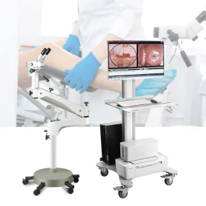 Original Manufacturer Price Medical Examination Mobile Binocular Gynecology Colposcope 2.1 Million Effective Pixels