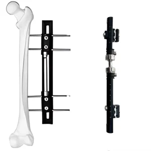 Orthopedic Surgical Instruments Femur & Tibial External Fixator Orthopedic Surgical Implant Bone Surgery Fixation