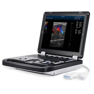 Portable Ultrasound Scanner DCU30 Full Digital Doppler Ultrasound Diagnostic Device for Dogs and Cats for Abdominal