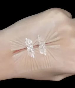 Professional Disposable Medical Adhesive Non invasive Skin Closure Wound PU Skin Coated Closures