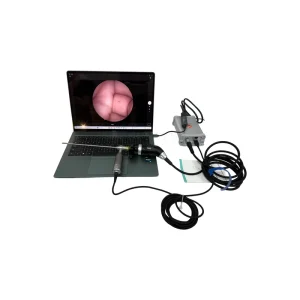 SY P2113 Premium Surgical Rigid Endoscope Sheath Kit for Neurosurgery Brain Ventricle Procedure