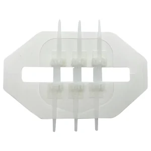 Self Adhesive Wound Dressing Zip Stitch Wound Closure Zipper Device for Minor Cuts Abrasions and Post Operative Wound Care