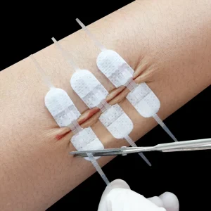 Self Adhesive Zip Sutures Wound Closure Device Non Woven Fabric Butterfly Bandages First Aid Wound Care Dressings