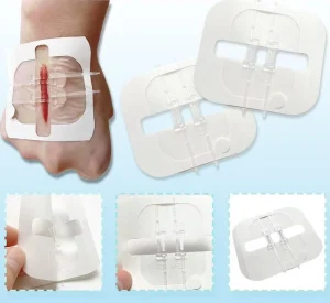 Skin Color Waterproof Zip Stitch Wound Closure Device Medical Non woven Adhesive Wound Closure Strip ISO13485