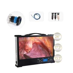 Small Mini Integrated Endoscopy Camera System For Ent Laparoscopy Ureteroscope Fiberscope For Hospital