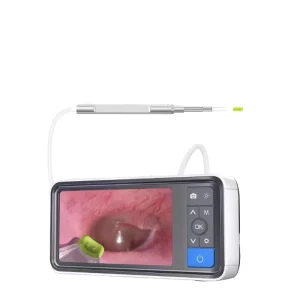 Special Visual Large 4.5 Inch Ultra High Definition Metal OToscope Luminous Ear Spoon 3.9mm Screen Endoscope Reusable Dog