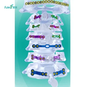 Titanium Spine Surgery Systems Posterior Cervical Laminoplasty Orthopedic Surgery Implant Class III CE Certified