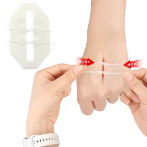 Transparent Zip Stitch Dressing Emergency Protection Wound Closure Device Zipper Wound Closure Device