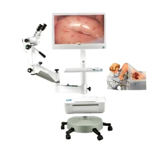 Trolley Electronic Video Digital Vaginal Colposcope Machine Optical Camera Software Gynecology Surgical Instruments
