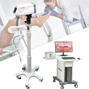 Vaginal Examination Device Kernel Vaginal Colposcopy Gynecological Disease Diagnostic Instrument KN-2200