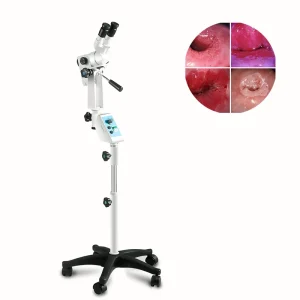 Video Electronic Colposcopy Camera Optical Colposcope for Gynecology KN-2200BI Vaginal Colposcope Imaging System