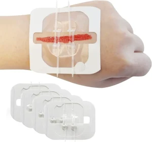 Waterproof Large Butterfly Wound Closure Strips Surgical Sterile Adhesive Wound Skin