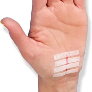 Wound Closure Skin Closure Strips Adhesive for Closing Supporting Cuts Suture