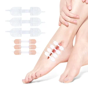 Wound Closure Strips Device Stitch Skin Stretching and Secure Wound Closure System Without Stitches Wound Closure