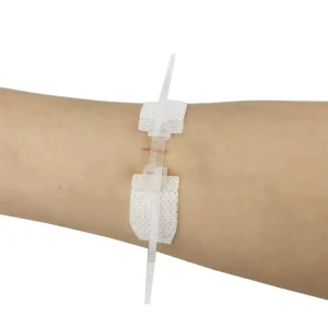Wound Closure Strips Device Stitch Zip Closured Wound for Wound Care