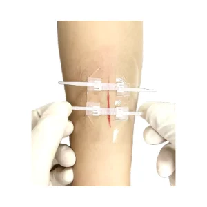 Wound Closure Surgical Wound Care Dressing for Wound Emergency Laceration Closure Kit for Lacerations and Cuts