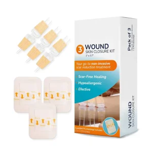 Wound Skin Closure Device Beneficial for Stopping Bleeding During Outdoor Activities