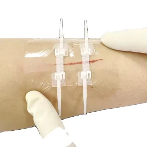 Zip Stitch Sutures Steri Strips Bandaid Emergency Wound Closure Butterfly Bandages