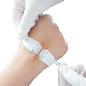 Zip Stitch Sutures Wound Closure Device Skin Closure Strips