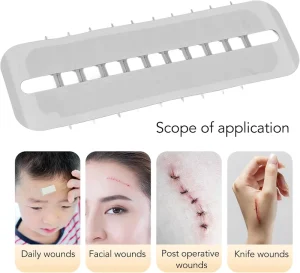 Zip Stitch Wound Closure Device