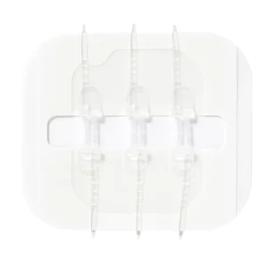 Zip Stitch Wound Closure Device