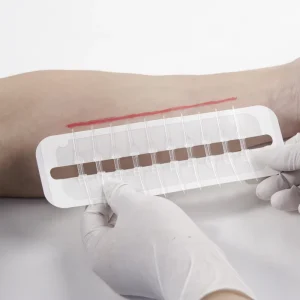 Zip Stitch Wound Closure Device Medical Polymer Material EO Sterile CE Certified JOINLINGMED JL01317 2