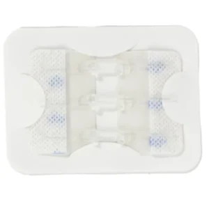 Zip Stitch Wound Closure Wound Closure Device