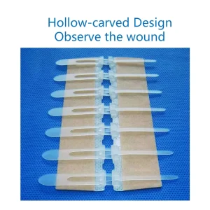 Zip Wound Closure Device Without Stitches