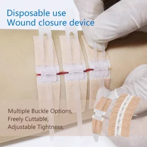 Zipper Painless Wound Closure Device Suture free Wound Dressing Closure Strips Kit Emergency Laceration Closures
