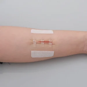 Zipper Painless Wound Closure Device Suture free Wound Dressing Closure Strips Kit Emergency Laceration Closures Far Infrared